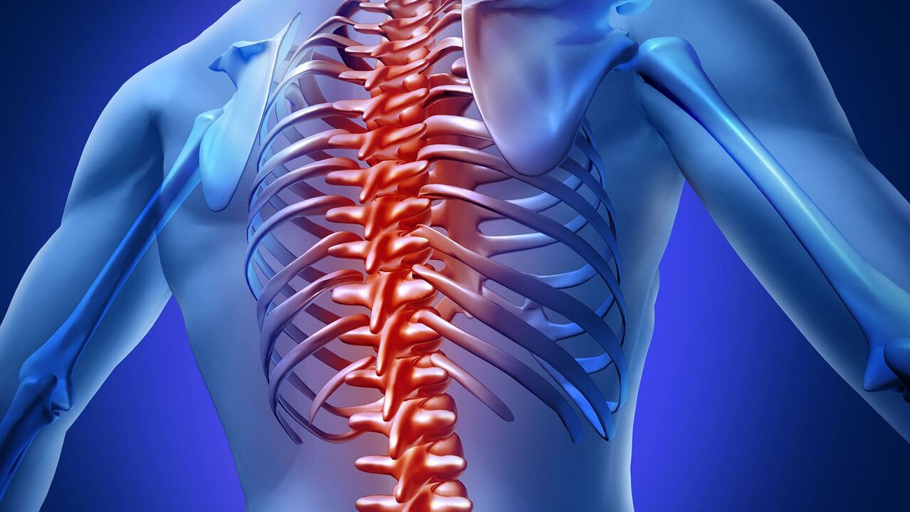 Krūšu kurvja osteohondroze